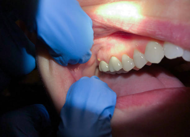 Best Emergency Dental Surgery in Summerde, AL
