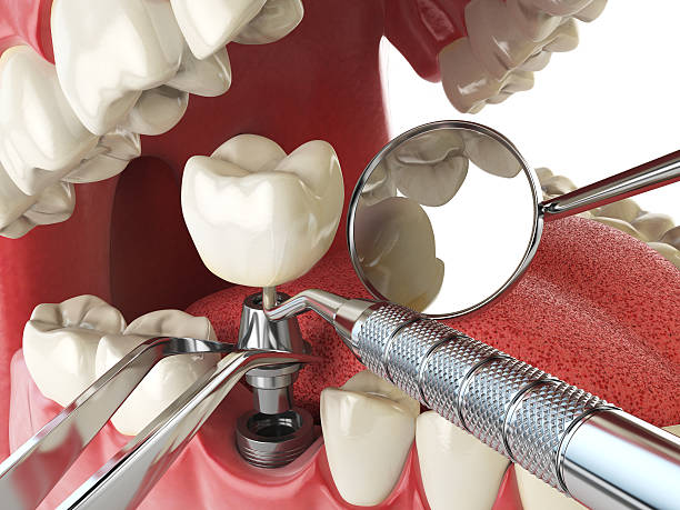 Best Emergency Treatment for Toothache in Summerde, AL